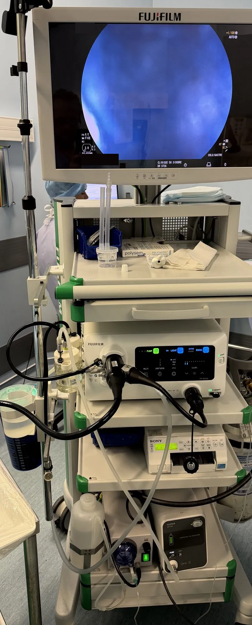 Colonne d'endoscopie Fujifilm utilisée pour la gastroscopie et la coloscopie